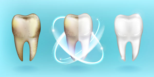 diş çürümesinin sebepleri nelerdir, cürük dis nasıl teshis edilir