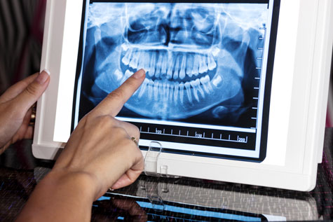 dental radyoloji dental görüntüleme istanbul diş kliniği