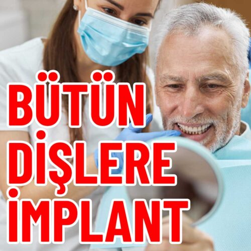 bütün-dişlere-implant-yaptırmak bütün-dişlere-implant-yaptırmak