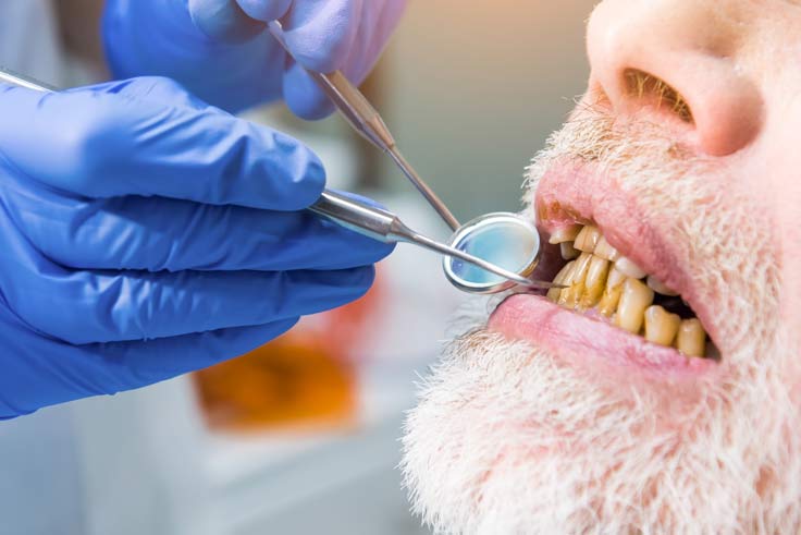implant diş tedavisi kimlere uygulanabilir