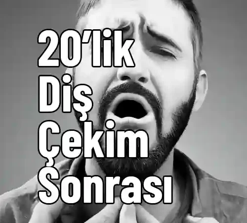 20'lik Diş Çekimi Sonrası Yutkunma Zorluğu - Dikiş Patlaması 20'lik Diş Çekimi Sonrası Yutkunma Zorluğu - Dikiş Patlaması