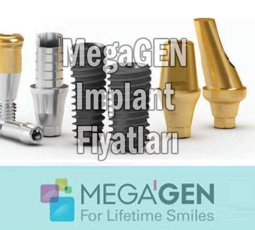 megagen implant