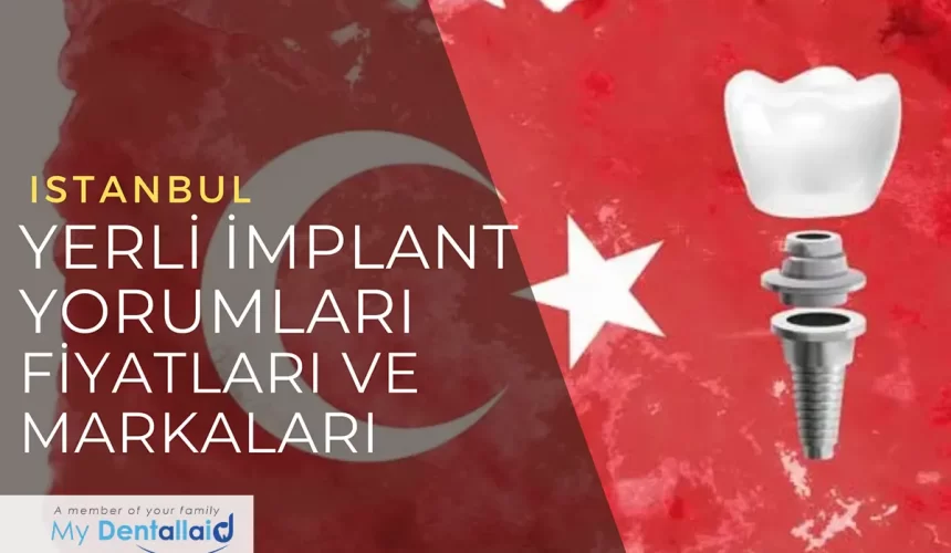 yerli implant-yorumlari-markalari-fiyatlari Yerli İmplant Yorumları, Markaları ve Fiyatları | Kaliteli ve Uygun Fiyatlı Yerli İmplantlar