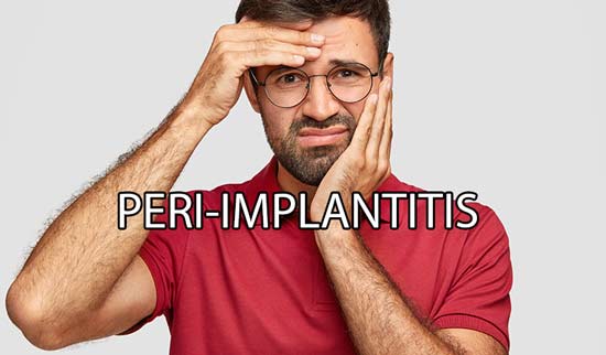peri-implantititis