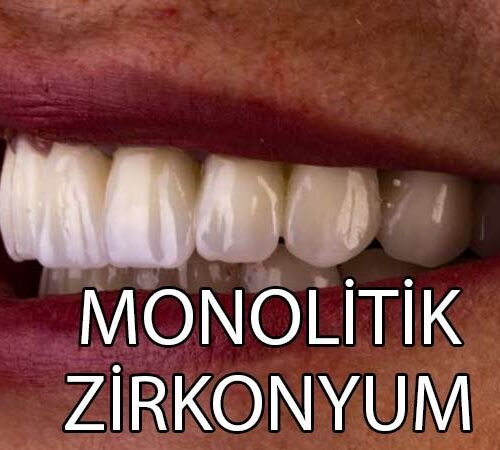 monolitik zirkonyum
