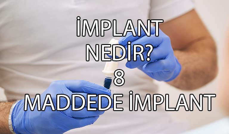 implant nedir